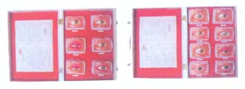 人体骨骼模型|常见眼病模型