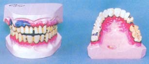 解剖模型|烟民式口腔牙列模型