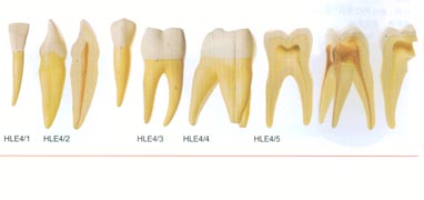 医学教学模型|前磨牙有一个牙根模型