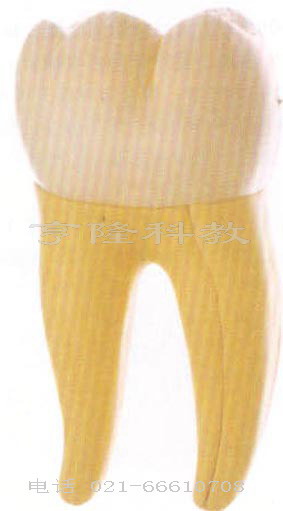 解剖模型|右测第一下磨牙模型