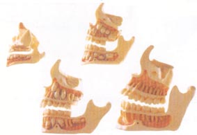 解剖教学模型|牙与颌骨的发育模型