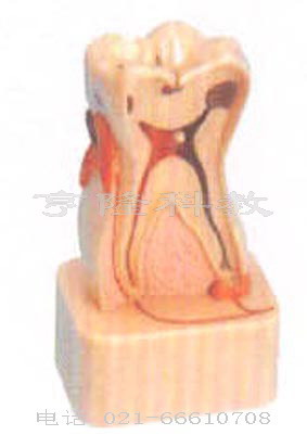 解剖模型|牙齿病变综合病理分解模型