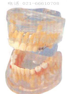 医学模型|透明乳牙发育模型