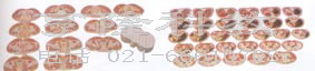人体解剖模型|男性躯干断层解剖横切面模型