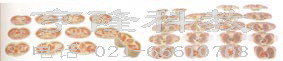 解剖教学模型|女性躯干断层解剖横切面模型