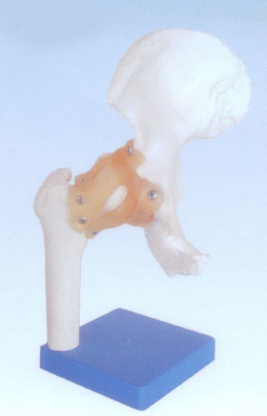 自然大髋关节模型