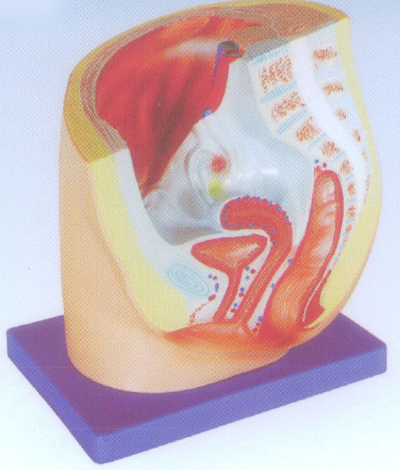 女性矢状解剖1件