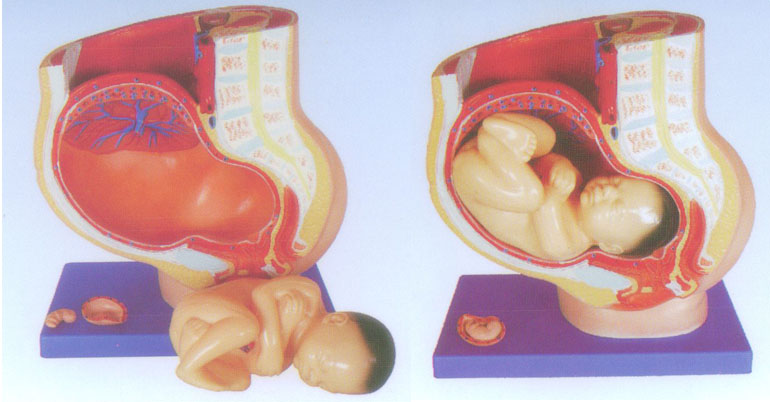 女性矢状解剖（4件）