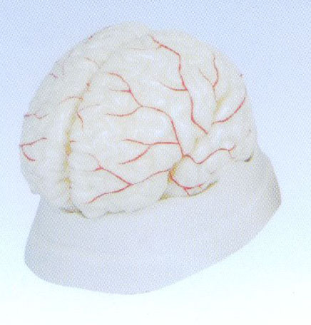 脑动脉模型