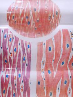 医学教学挂图|医学挂图|医学人体教学挂图|病理学挂图