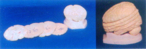 脑小平（横向）切具座模型（5件）