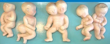 胎儿畸形模型(8部件)
