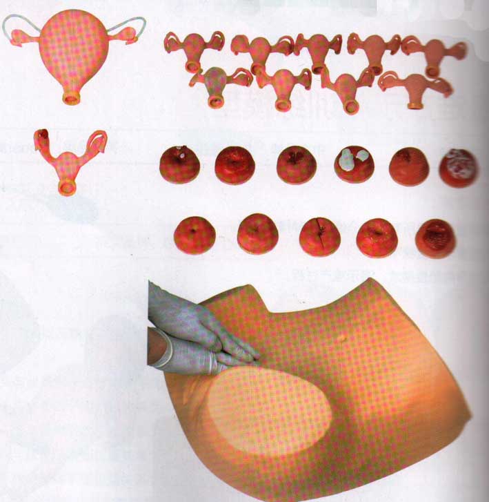 妇幼训练模型|高级妇科检查模型