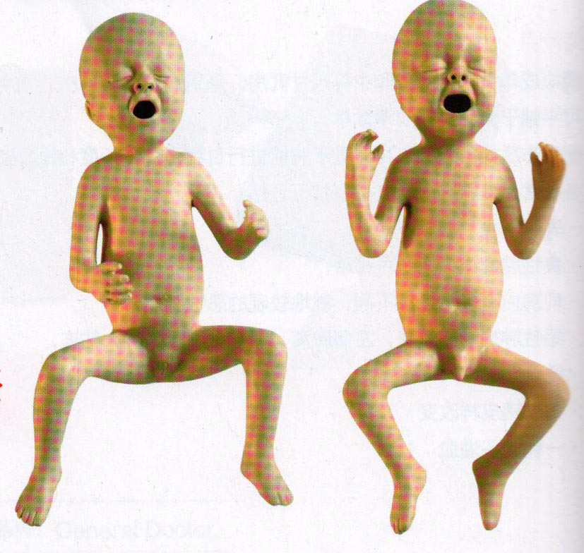 高级24周/30周早产儿模型