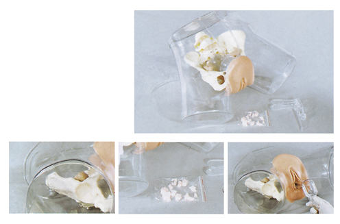 高级透明刮宫模型