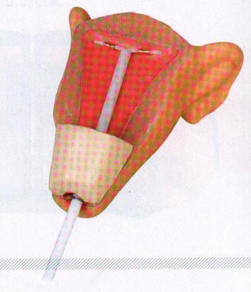 高级宫内避孕器训练模型