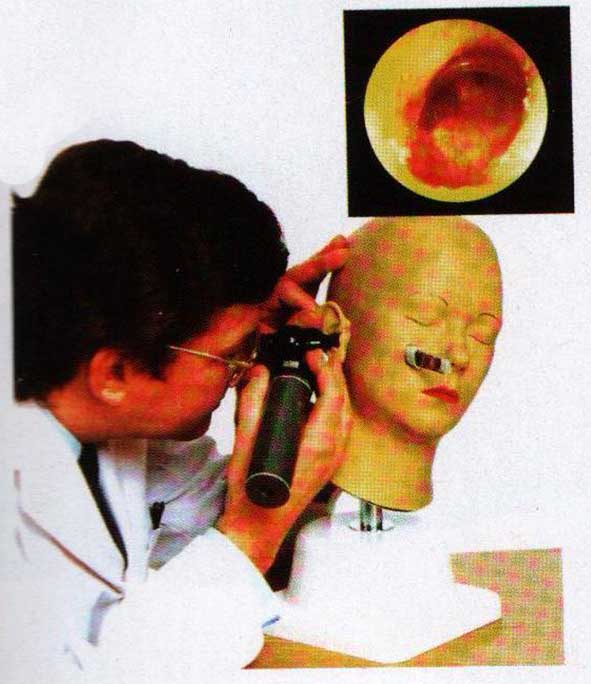 高级耳诊断模型