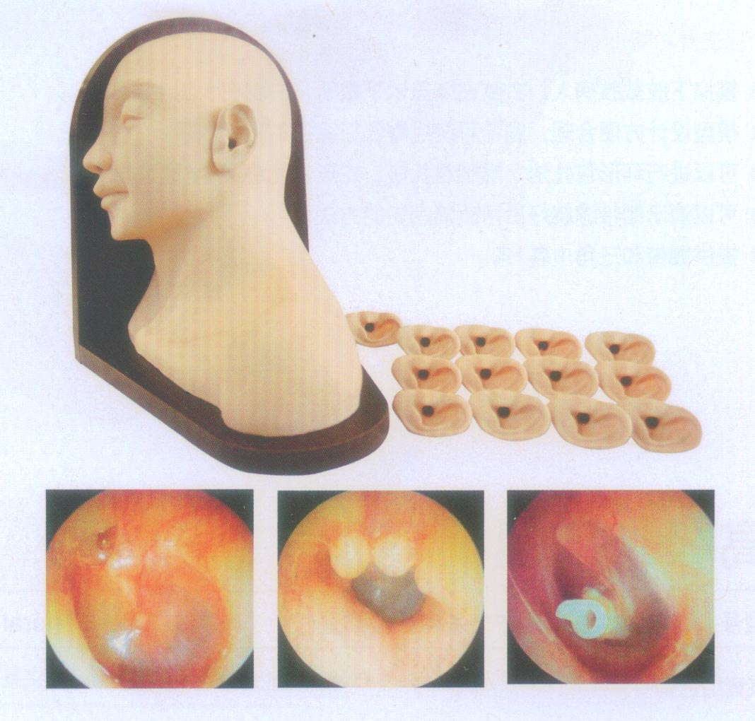 高级耳部检查模型