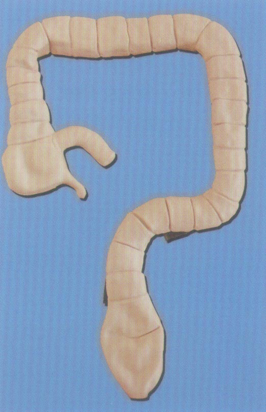 乙状结肠镜检查模型