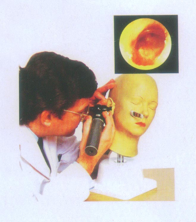 高级耳诊断模型