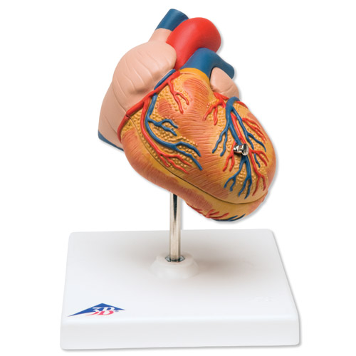经典心脏模型，呈左心室肥大，2部分