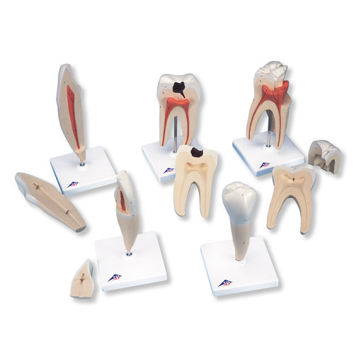 经典牙齿模型系列，5种模型