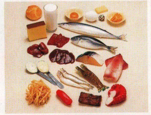 痛风症饮食指导模型