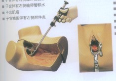 高级会阴切开缝合技能训练模型