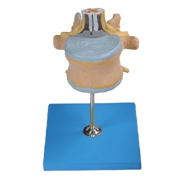 腰椎附脊髓与马尾神经放大模型