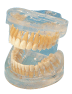 透明牙体病理模型