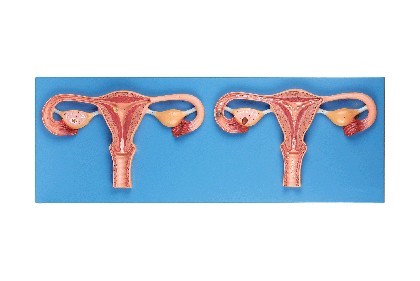 卵子受精过程放大模型