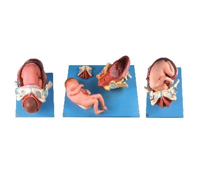 足月胎儿分娩过程模型
