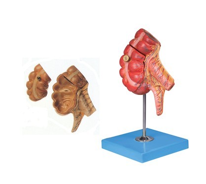 盲肠和阑尾模型