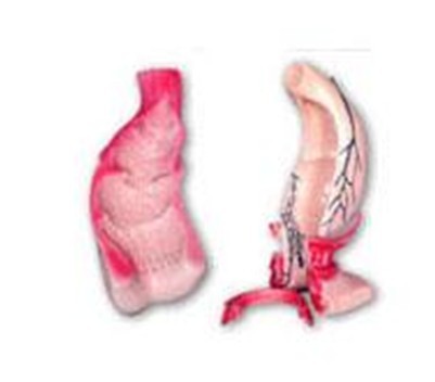 直肠和肛管模型