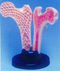 大型股骨剖面比较(健康与疏松)模型