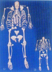 168cm人体骨骼全身散骨模型