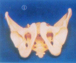 成人男性盆骨模型