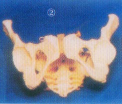 成人女性盆骨模型