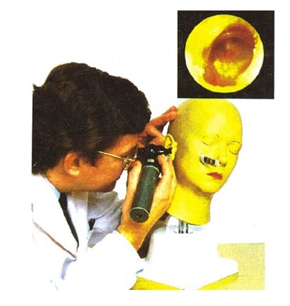 高级耳诊断模型