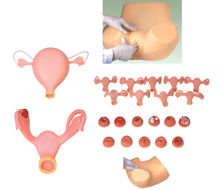 高级妇科检查模型