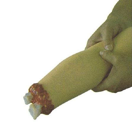 上肢外伤断肢止血模型