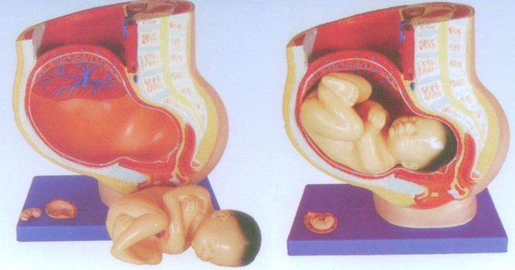 女性矢状解剖(4件)