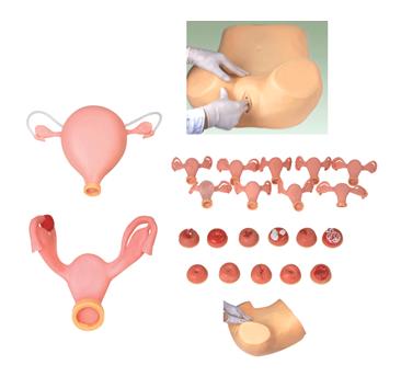 高级妇科检查模型